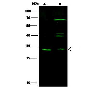 Western Blot: ATPase Na+/K+ beta 3 Antibody [NBP2-98896] - Anti-ATPase Na+/K+ beta 3 rabbit polyclonal antibody at 1:500 dilution. Lane A: Hela Whole Cell Lysate. Lane B: A431 Whole Cell Lysate. Lysates/proteins at 30 ug per lane. Secondary Goat Anti-Rabbit IgG H&L (Dylight 800) at 1/10000 dilution. Developed using the Odyssey technique. Performed under reducing conditions. Predicted band size: 32 kDa. Observed band size: 32 kDa (We are unsure as to the identity of these extra bands).