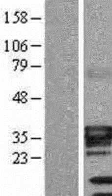 Western Blot: ATPase Na+/K+ beta 3 Overexpression Lysate (Native) [NBL1-07812] - Left-Empty vector transfected control cell lysate (HEK293 cell lysate); Right -Over-ATPase Na+/K+ beta 3 Overexpression Lysate (Native).