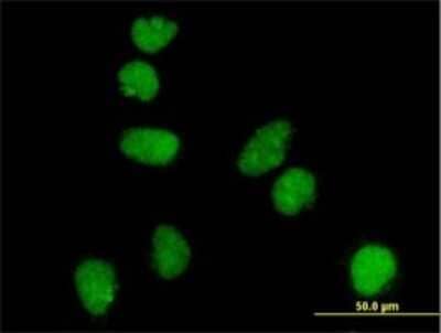 Immunocytochemistry/Immunofluorescence: ATR Antibody (3F2) [H00000545-M01] - Analysis of monoclonal antibody to ATR on HeLa cell . Antibody concentration 10 ug/ml.