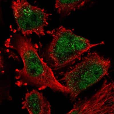 Immunocytochemistry/Immunofluorescence: ATR Antibody [NBP2-76547] - Staining of human cell line U-251 MG shows localization to nucleoplasm & the Golgi apparatus. Antibody staining is shown in green.