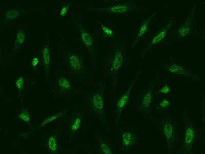 Immunocytochemistry/Immunofluorescence: ATR Antibody [NBP2-98982] - Immunofluorescence staining of ATR in Hela cells. Cells were fixed with 4% PFA, permeabilzed with 0.1% Triton X-100 in PBS, blocked with 10% serum, and incubated with rabbit anti-Human ATR polyclonal antibody (dilution ratio 1:500) at 4C overnight. Then cells were stained with the Alexa Fluor(R)488-conjugated Goat Anti-rabbit IgG secondary antibody (green). Positive staining was localized to Nucleus .