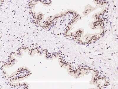 Immunohistochemistry-Paraffin: ATR Antibody [NBP2-98982] - Immunochemical staining ATR in human prostate with rabbit polyclonal antibody at 1:200 dilution, formalin-fixed paraffin embedded sections.