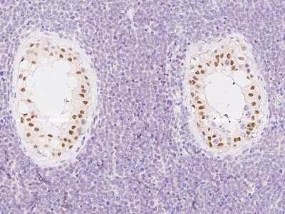 Immunohistochemistry-Paraffin: ATR Antibody [NBP2-98982] - Immunochemical staining ATR in human testis with rabbit polyclonal antibody at 1:300 dilution, formalin-fixed paraffin embedded sections.