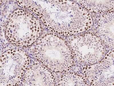 Immunohistochemistry-Paraffin: ATR Antibody [NBP2-98982] - Immunochemical staining ATR in mouse testis with rabbit polyclonal antibody at 1:200 dilution, formalin-fixed paraffin embedded sections.