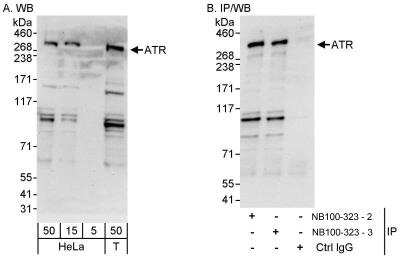 <b>Independent Antibodies Validation and Biological Strategies Validation.</b>Western Blot: ATR Antibody [NB100-323] - Whole cell lysate from HeLa (5, 15 and 50 ug for WB; 1 mg for IP, 20% of IP loaded) and 293T (T; 50 ug) cells. Antibodies: Affinity purified rabbit anti-ATR antibody NB100-323 lot 3 used for WB at 0.1 ug/ml (A) and 1 ug/ml (B) and used for IP at 3 ug/mg lysate (B). ATR was also immunoprecipitated by a previous lot (lot 2) of this antibody. Detection: Chemiluminescence with exposure times of 30 seconds (A) and 10 seconds (B).