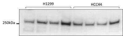 Western Blot: ATR Antibody [NB100-323] - H1299 (human lung cancer cells) and HCC 44 (human liver cancer cells). Antibody at 1:500. Image submitted by a verified customer review. 