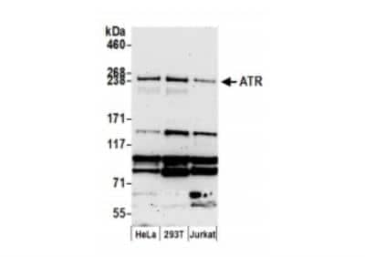 Western Blot: ATR Antibody [NB100-323] -  Whole cell lysate (15 ug) from HeLa, HEK293T, and Jurkat cells prepared using NETN lysis buffer. Antibody: Affinity purified rabbit anti-ATR antibody used for WB at 0.4 ug/ml. Detection: Chemiluminescence with an exposure time of 3 minutes.