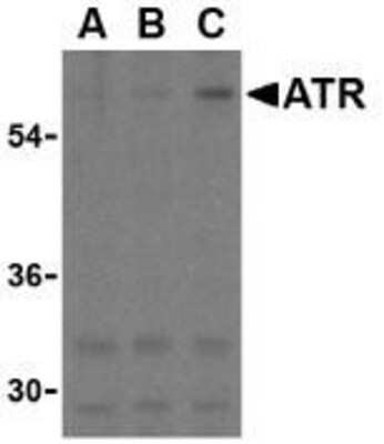 Western Blot: ATR Antibody [NBP1-77232] - K562 cell lysates with ATR antibody at (A) 0.5, (B) 1, and (C) 2 ug/ml.