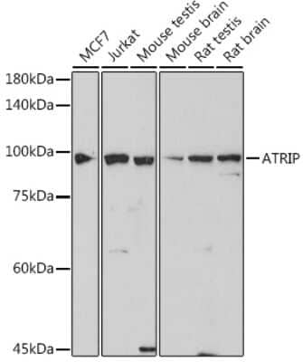 Western Blot: ATRIP Antibody (2C4B6) [NBP3-15738] - Western blot analysis of extracts of various cell lines, using ATRIP antibody (NBP3-15738) at 1:1000 dilution. Secondary antibody: HRP Goat Anti-Rabbit IgG (H+L) at 1:10000 dilution. Lysates/proteins: 25ug per lane. Blocking buffer: 3% nonfat dry milk in TBST. Detection: ECL Basic Kit. Exposure time: 180s.