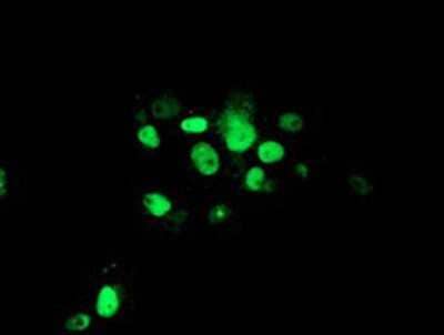 Immunocytochemistry/Immunofluorescence: ATRIP Antibody (OTI5E7) [NBP2-02004] -  Staining of COS7 cells transiently transfected by pCMV6-ENTRY ATRIP.