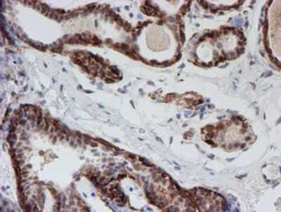 Immunohistochemistry-Paraffin: ATRIP Antibody (OTI5E7) [NBP2-02004] -  Staining of paraffin-embedded Human breast tissue using anti-ATRIP mouse monoclonal antibody.