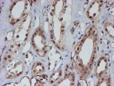 Immunohistochemistry-Paraffin: ATRIP Antibody (OTI5E7) [NBP2-02004] - Staining of paraffin-embedded Human Kidney tissue using anti-ATRIP mouse monoclonal antibody.