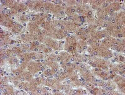 Immunohistochemistry-Paraffin: ATRIP Antibody (OTI5E7) [NBP2-02004] - Staining of paraffin-embedded Human liver tissue using anti-ATRIP mouse monoclonal antibody.