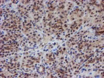 Immunohistochemistry-Paraffin: ATRIP Antibody (OTI5E7) [NBP2-02004] - Staining of paraffin-embedded Human pancreas tissue using anti-ATRIP mouse monoclonal antibody.