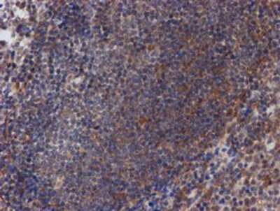 Immunohistochemistry-Paraffin: ATRIP Antibody (OTI5E7) [NBP2-02004] -  Staining of paraffin-embedded Human tonsil using anti-ATRIP mouse monoclonal antibody.