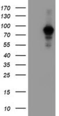 Western Blot: ATRIP Antibody (OTI5E7) [NBP2-02004] -  HEK293T cells were transfected with the pCMV6-ENTRY control (Left lane) or pCMV6-ENTRY ATRIP (Right lane) cDNA for 48 hrs and lysed. Equivalent amounts of cell lysates (5 ug per lane) were separated by SDS-PAGE and immunoblotted with anti-ATRIP.