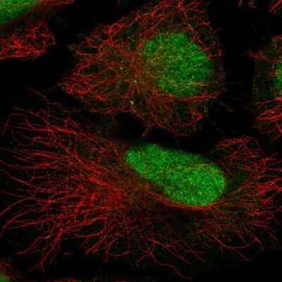 Immunocytochemistry/Immunofluorescence: ATRIP Antibody [NBP2-55702] - Staining of human cell line HeLa shows localization to nucleus.