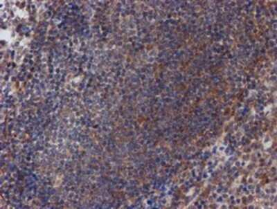 Immunohistochemistry: ATRIP Antibody (OTI5E7) - Azide and BSA Free [NBP2-72271] - Staining of paraffin-embedded Human tonsil using anti-ATRIP mouse monoclonal antibody.