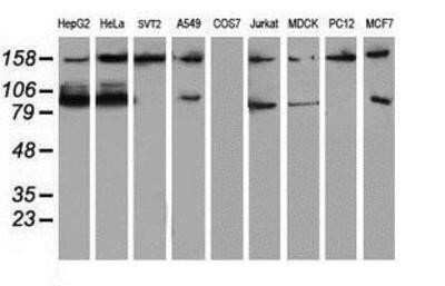 Western Blot: ATRIP Antibody (OTI5E7) - Azide and BSA Free [NBP2-72271] - Analysis of extracts (35ug) from 9 different cell lines by using g anti-ATRIP monoclonal antibody (HepG2: human; HeLa: human; SVT2: mouse; A549: human; COS7: monkey; Jurkat: human; MDCK: canine; PC12: rat; MCF7: human).