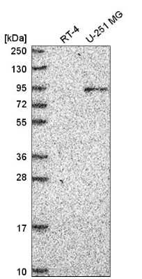 Western Blot: ATRIP Antibody [NBP2-55702] - Western blot analysis in human cell line RT-4 and human cell line U-251 MG.