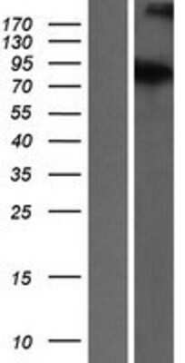 Western Blot: ATRIP Overexpression Lysate (Adult Normal) [NBL1-07853] Left-Empty vector transfected control cell lysate (HEK293 cell lysate); Right -Over-expression Lysate for ATRIP.