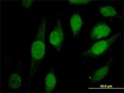 Immunocytochemistry/Immunofluorescence: ATRX Antibody (5B3) [H00000546-M03] - Analysis of monoclonal antibody to ATRX on HeLa cell. Antibody concentration 20 ug/ml
