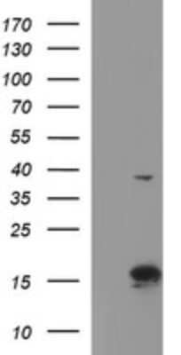 Western Blot: ATXN7L1 Antibody (OTI4F6) - Azide and BSA Free [NBP2-72464] - Analysis of HEK293T cells were transfected with the pCMV6-ENTRY control (Left lane) or pCMV6-ENTRY ATXN7L1 .
