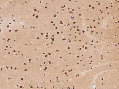Immunohistochemistry-Paraffin: ATXN7L2 Antibody [NBP2-98179] - Immunochemical staining of human ATXN7L2 in human brain with rabbit polyclonal antibody at 1:500 dilution, formalin-fixed paraffin embedded sections.