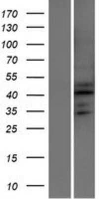 Western Blot: ATXN7L2 Overexpression Lysate (Adult Normal) [NBP2-05257] Left-Empty vector transfected control cell lysate (HEK293 cell lysate); Right -Over-expression Lysate for ATXN7L2.