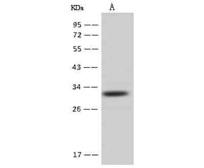 Western Blot: AUH Antibody [NBP2-97719] - Anti-AUH rabbit polyclonal antibody at 1:500 dilution. Lane A: HepG2 Whole Cell Lysate Lysates/proteins at 30 ug per lane. Secondary Goat Anti-Rabbit IgG (H+L)/HRP at 1/10000 dilution. Developed using the ECL technique. Performed under reducing conditions. Predicted band size: 32 kDa. Observed band size: 32 kDa