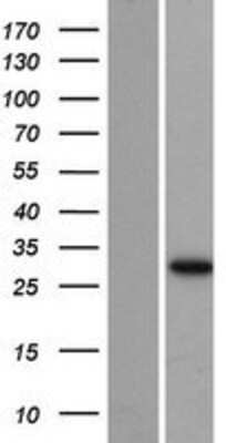 Western Blot: AUH Overexpression Lysate (Adult Normal) [NBP2-08182] Left-Empty vector transfected control cell lysate (HEK293 cell lysate); Right -Over-expression Lysate for AUH.