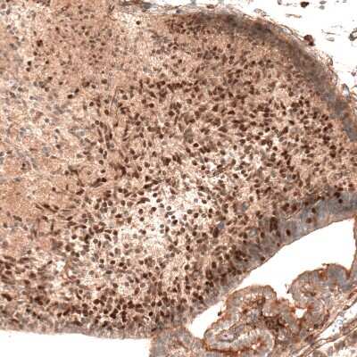 Immunohistochemistry-Paraffin: AUTS2 Antibody (CL7067) [NBP2-76529] - Staining of mouse embryo E14 shows moderate nuclear positivity in neuronal cells in the developing cerebellum.