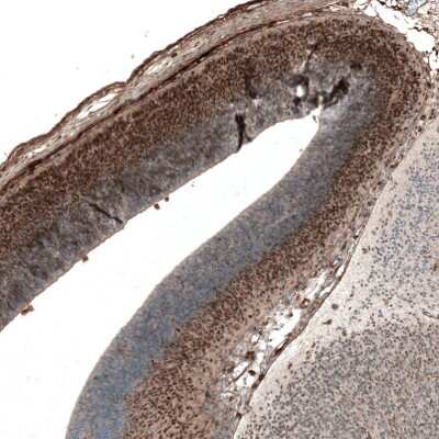 Immunohistochemistry-Paraffin: AUTS2 Antibody (CL7084) [NBP2-76530] - Staining of mouse embryo E14 shows moderate nuclear positivity in neuronal cells in developing cortex.