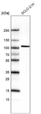 Western Blot: AUTS2 Antibody (CL7084) [NBP2-76530] - Analysis in human cell line SCLC-21H.