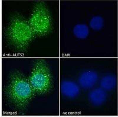 Immunocytochemistry/Immunofluorescence: AUTS2 Antibody [NBP3-05291] - Immunofluorescence analysis of paraformaldehyde fixed A431 cells, permeabilized with 0.15% Triton. Primary incubation 1hr (10 ug/mL) followed by Alexa Fluor 488 secondary antibody (2 ug/mL), showing nuclear and cytoplasmic staining. The nuclear stain is DAPI (blue). Negative control: Unimmunized goat IgG (10 ug/mL) followed by Alexa Fluor 488 secondary antibody (2 ug/mL).