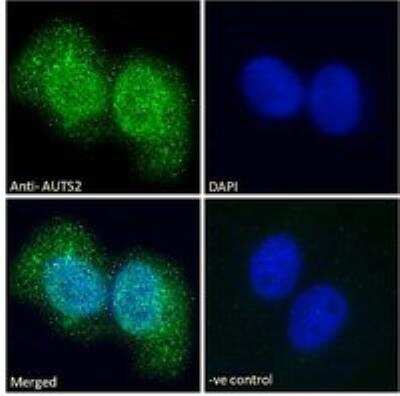 Immunocytochemistry/Immunofluorescence: AUTS2 Antibody [NBP3-05291] - Immunofluorescence analysis of paraformaldehyde fixed U2OS cells, permeabilized with 0.15% Triton. Primary incubation 1hr (10 ug/mL) followed by Alexa Fluor 488 secondary antibody (2 ug/mL), showing nuclear and cytoplasmic staining. The nuclear stain is DAPI (blue). Negative control: Unimmunized goat IgG (10 ug/mL) followed by Alexa Fluor 488 secondary antibody (2 ug/mL).