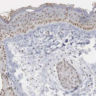 Immunohistochemistry-Paraffin: AUTS2 Antibody [NBP1-84717] - Staining of human skin shows moderate nuclear positivity.