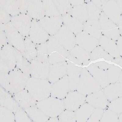 Immunohistochemistry-Paraffin: AUTS2 Antibody [NBP1-84717] - Staining of human skeletal muscle shows very weak to negative nuclear positivity in monocytes.