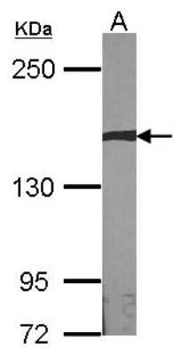 Western Blot: AUTS2 Antibody [NBP1-32784] - Sample (30 ug of whole cell lysate) A:NIH-3T3 15% SDS PAGE; antibody diluted at 1:1000.