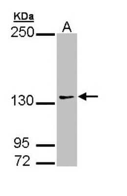 Western Blot: AUTS2 Antibody [NBP1-32784] - Sample (30 ug of whole cell lysate) A: 293T 7.5% SDS PAGE, antibody diluted at 1:1000.