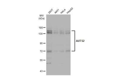 Western Blot: AUTS2 Antibody [NBP1-32784] - Various whole cell extracts (30 ug) were separated by 7.5% SDS-PAGE, and the membrane was blotted with AUTS2 antibody diluted at 1:1000.