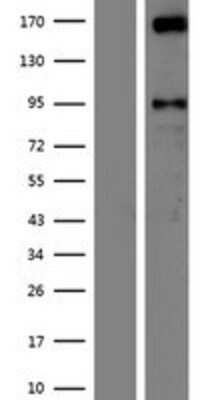 Western Blot: AUTS2 Overexpression Lysate (Adult Normal) [NBP2-09437] Left-Empty vector transfected control cell lysate (HEK293 cell lysate); Right -Over-expression Lysate for AUTS2.