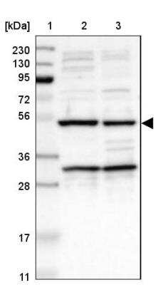 Western Blot: AVEN Antibody [NBP1-87313] - Lane 1: Marker  [kDa] 230, 130, 95, 72, 56, 36, 28, 17, 11.  Lane 2: Human cell line RT-4.  Lane 3: Human cell line U-251MG sp