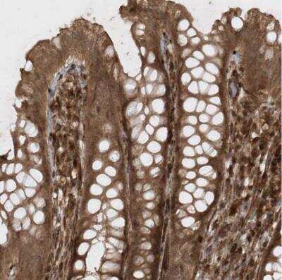 Immunohistochemistry-Paraffin: AVPI1 Antibody [NBP1-80888] - Staining of human rectum shows strong cytoplasmic positivity in glandular cells.