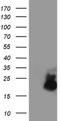 Western Blot: AVPI1 Antibody (OTI1G1) - Azide and BSA Free [NBP2-72121] - Analysis of HEK293T cells were transfected with the pCMV6-ENTRY control (Left lane) or pCMV6-ENTRY AVPI1.