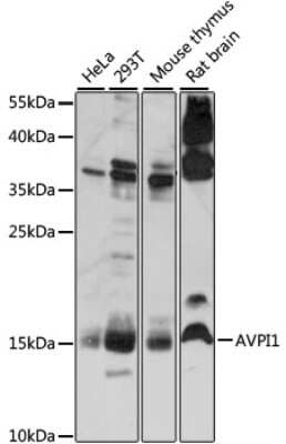 Western Blot: AVPI1 Antibody [NBP2-92241] - Analysis of extracts of various cell lines, using AVPI1 at 1:1000 dilution.Secondary antibody: HRP Goat Anti-Rabbit IgG (H+L) at 1:10000 dilution.Lysates/proteins: 25ug per lane.Blocking buffer: 3% nonfat dry milk in TBST.Detection: ECL Basic Kit .Exposure time: 30s.