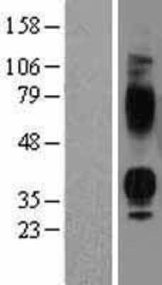 Western Blot: AVPR1B Overexpression Lysate (Adult Normal) [NBP2-04173] Left-Empty vector transfected control cell lysate (HEK293 cell lysate); Right -Over-expression Lysate for AVPR1B.