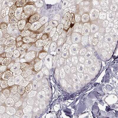 Immunohistochemistry-Paraffin AWAT1 Antibody