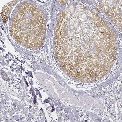Immunohistochemistry-Paraffin: AWAT2 Antibody [NBP2-38003] - Staining of human skin shows moderate cytoplasmic positivity in sebaceous gland.