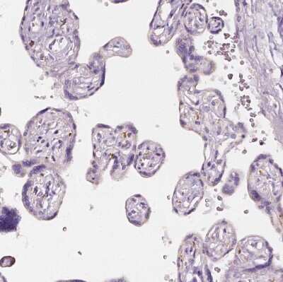 Immunohistochemistry-Paraffin: AWAT2 Antibody [NBP2-38003] - Staining of human placenta shows no positivity in trophoblastic cells as expected.